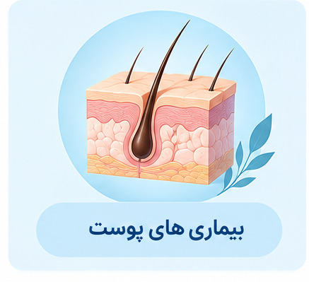 درمان آکنه و جوش، پسوریازیس، ریزش مو و ...